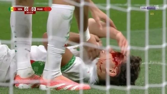 نزيف وإصابة قوية تُربك نهائي كأس إفريقيا وتُقلق جماهير المنتخب بسبب نائل العيناوي